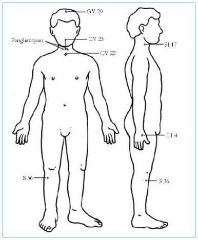 Acupression et acupuncture pour mieux dormir acupuncture pour mieux dormir