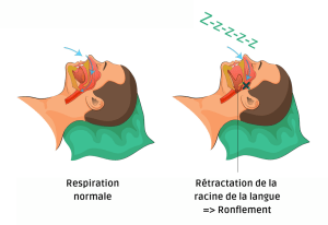 Comment dormir sans ronfler : 25 techniques infaillibles dormir sans ronfler